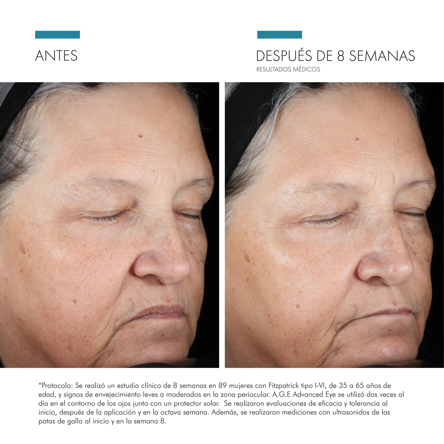 SKINCEUTICALS A.G.E. ADVANCED EYE 15ML