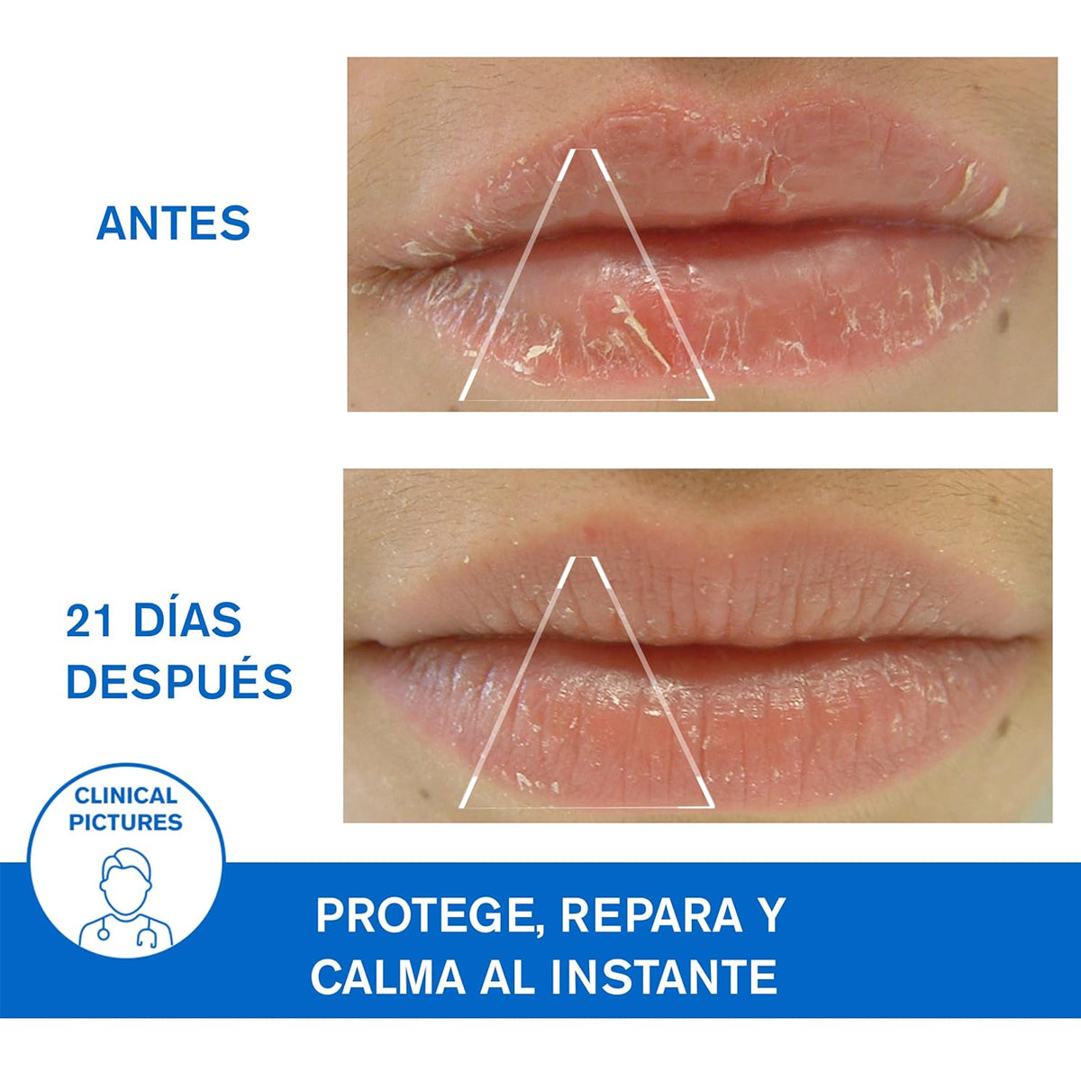 URIAGE BARIÉDERM-CICA PROTECTING LIP BALMING 15ML