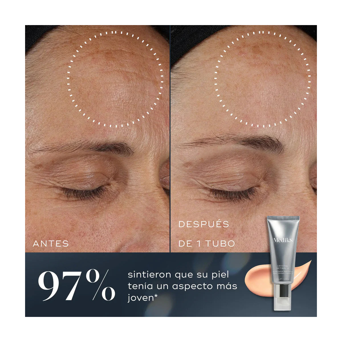 MEDIK8 CRYSTAL RETINAL 3 SÉRUM 30ML