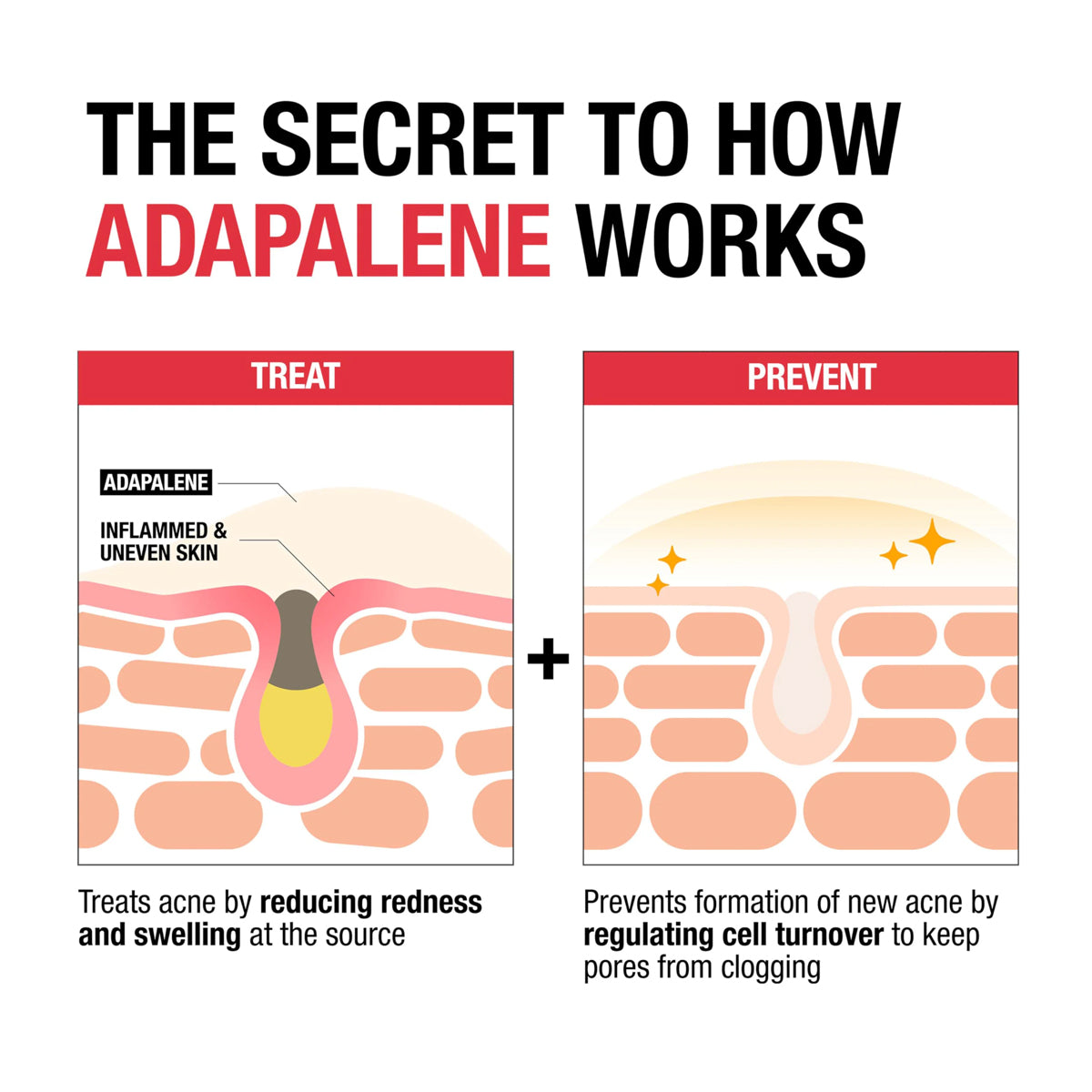 NEUTROGENA ADAPALENE GEL 0.1% ACNE TREATMENT 45GR