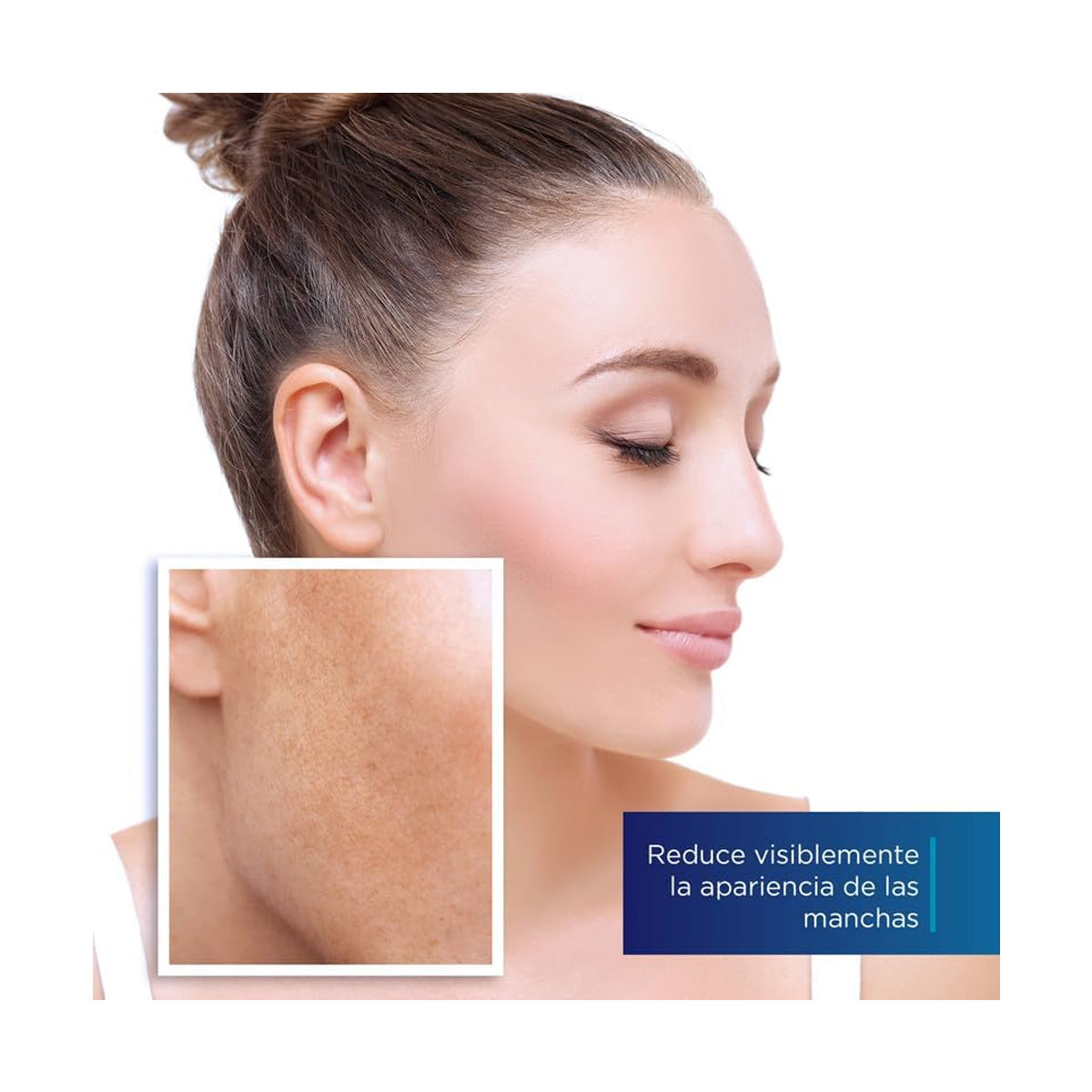 PANALAB VITANOIN BLEMISH SÉRUM DESPIGMENTANTE 30ML
