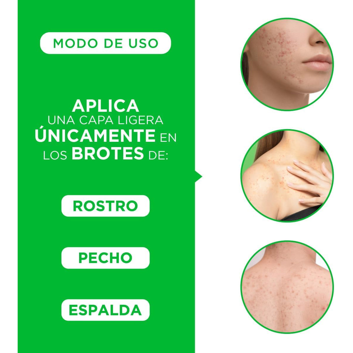 TRIOXIMED ANTIACNÉ GEL ANTIIMPERFECCIONES CON OZONO 30GR