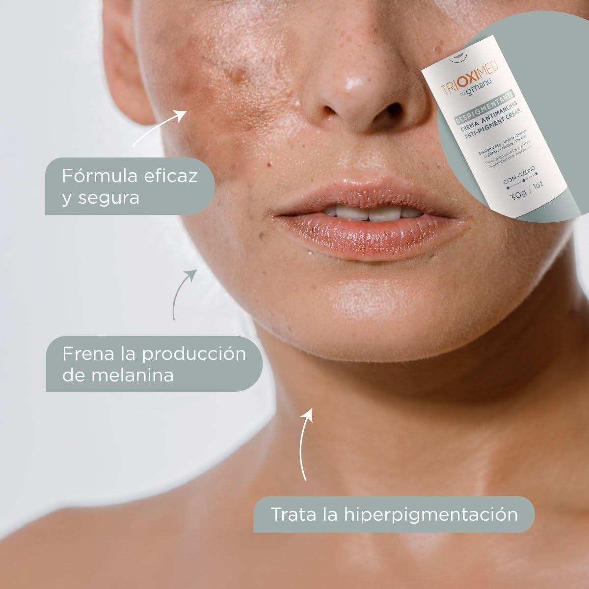TRIOXIMED DESPIGMENTANTE CREMA ANTIMANCHAS CON OZONO 30GR